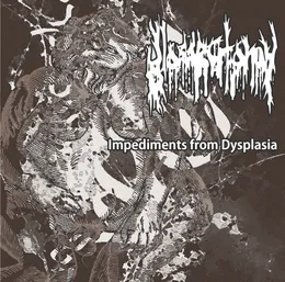 Impediments From Dysplasia von Glossectomy – Cover