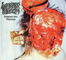 Pathogenesis Infest Phlegmsepia von Lymphatic Phlegm – Album Cover