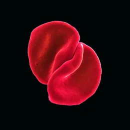 Scratch My Back von Peter Gabriel – Album Cover