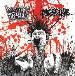Pulmonary Fibrosis / Mesrine von Mesrine – Album Cover