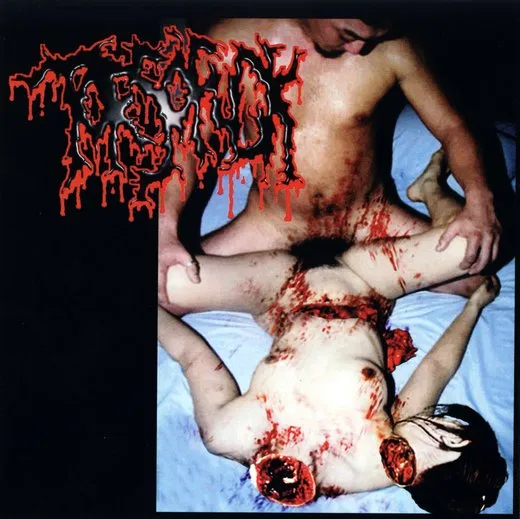 Disgusting Gore and Pathology / Polymorphisms to Severe Sepsis in Trauma