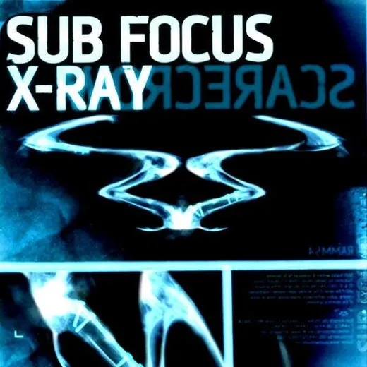 X‐Ray