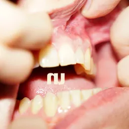 Bite My Tongue von Null Split – Cover