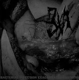 Bacterial Infection Exacerbates Gastriti von 3XA – Album Cover