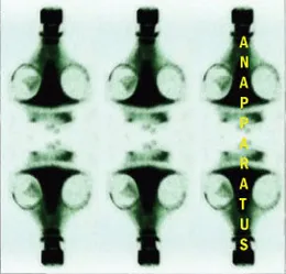Scars of Separation von Anapparatus – Cover