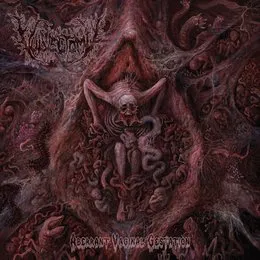 Aberrant Vaginal Gestation von Vulvectomy – Album Cover