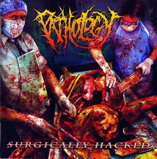 Surgically Hacked