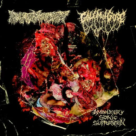 Ambulatory Sonic Suppuration