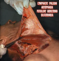 4-Way Split CD von Lymphatic Phlegm – Album Cover