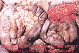 Malignant Cancerous Tumor in the Epitelial Tissue of the Intestine von Lymphatic Phlegm – Album Cover