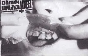 Skullfracturing Fastcore