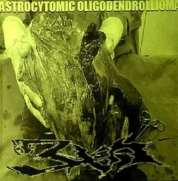 Astrocytomic Oligodendrollioma von 3XA – Album Cover